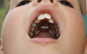 Harbor North Children's Orthodontics